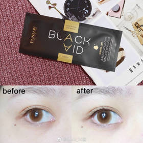 【少女留步，你的眼下有纹！】