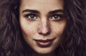 【长斑】孕期脸上为何会长小斑点？教你5招拒做“斑美人”！