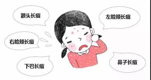 脸上的痘痘告诉你，身体哪里出了问题！ 商品图0