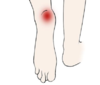 足跟痛的艾灸方法 商品缩略图0