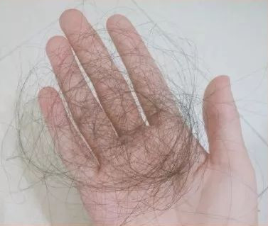 脱发已成为国民焦虑，你的头发还好吗？