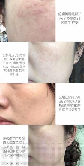 恼人的毛絮絮过敏怎么办?