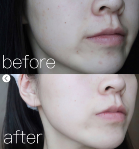 以油养肤，21天养出好肤质！