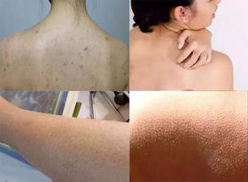 约会急救，一秒肌肤顺滑！