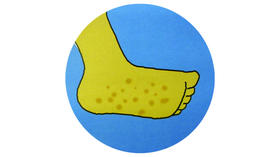 宝宝得手足口有什么明显的症状？