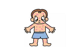 宝宝热痱如何护理？爽身粉、痱子粉推荐使用吗？