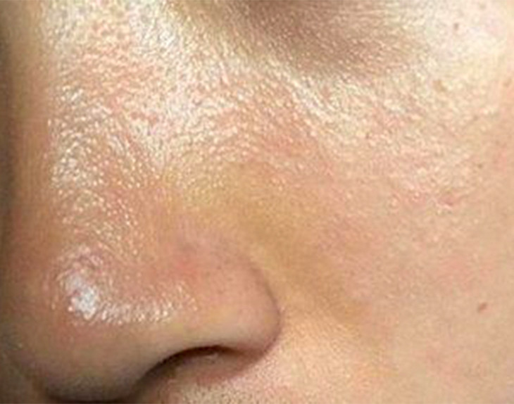 阿迪达斯 · 男士控油洁面膏 | 脸上出油少了,才更清爽