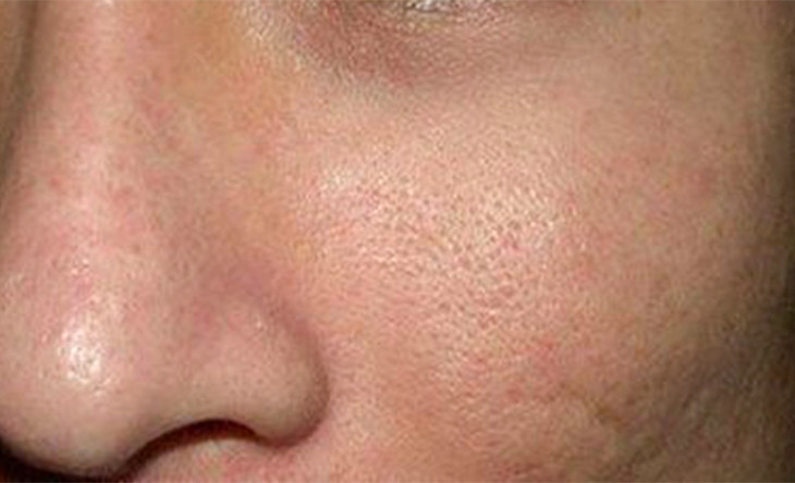 阿迪达斯 · 男士控油洁面膏 | 脸上出油少了,才更清爽