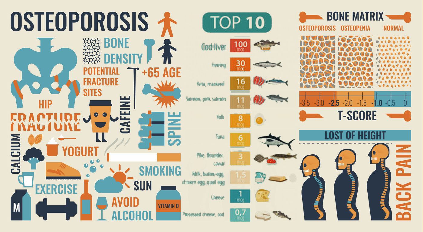维生素D在防治骨质疏松的全过程，被我们复原了