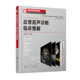 临床常见疾病超声图谱系列--血管超声诊断临床图解