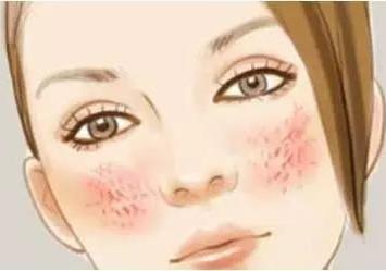 童话面膜 | 红血丝女孩要知道的护肤雷区！ 商品图0