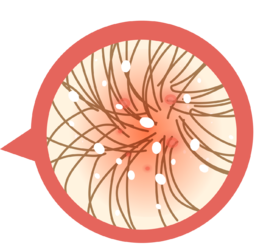 头皮出现淡红色红斑，不停搔抓怎么办？