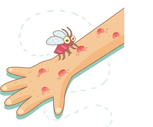 春夏季节宝宝被蚊虫叮咬，皮肤红肿怎么办？ 商品图0