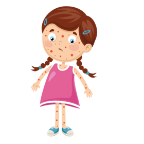 食物过敏的宝宝一些食物不能吃，宝宝缺营养怎么办？