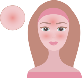 @宝妈，孩子被晒伤怎么办？快来学！