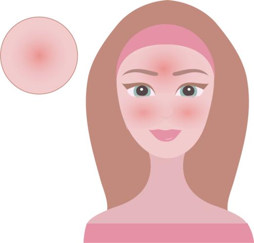 @宝妈，孩子被晒伤怎么办？快来学！ 商品图0