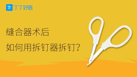 缝合器术后如何用拆钉器拆钉？ 商品图0