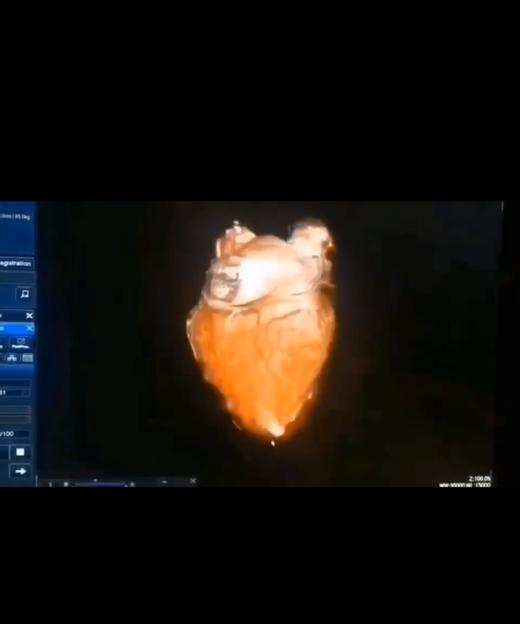 你不曾看不到过的肺 商品图0