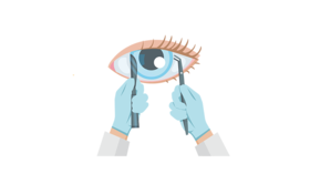 近视手术值得做吗？近视手术适合什么样的人？