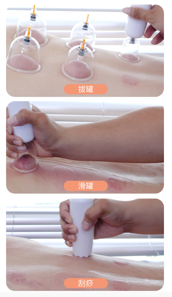 【在家就能拔罐刮痧】智能拔罐刮痧器 刮痧 拔罐 滑罐