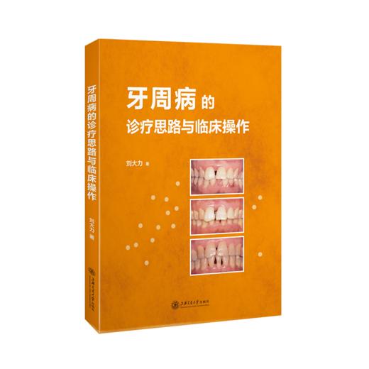 牙周病的诊疗思路与临床操作  9787313227348  刘大力 商品图1