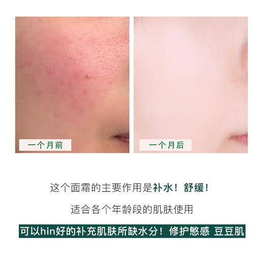 韩国Dr.G积雪草保湿面霜70ml 商品图6