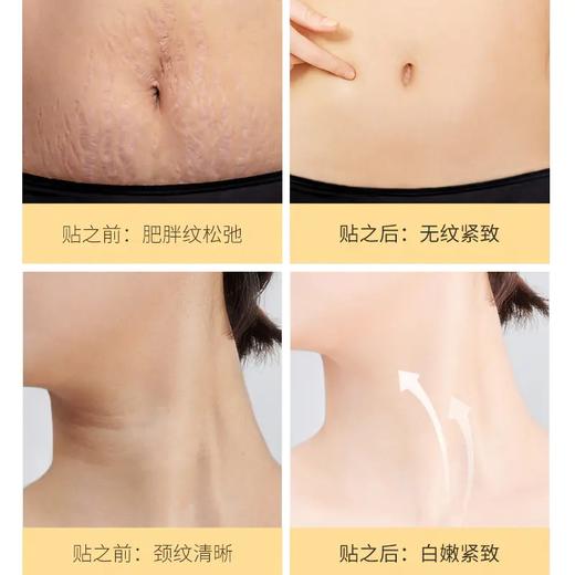 Anfany紧致嫩滑美腹贴——祛纹嫩滑，紧致收腹 商品图4