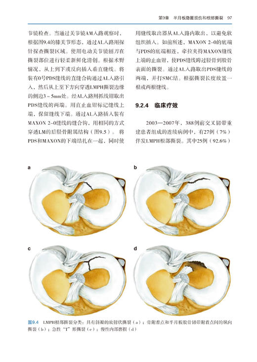 75折包邮《半月板手术学》 商品图3