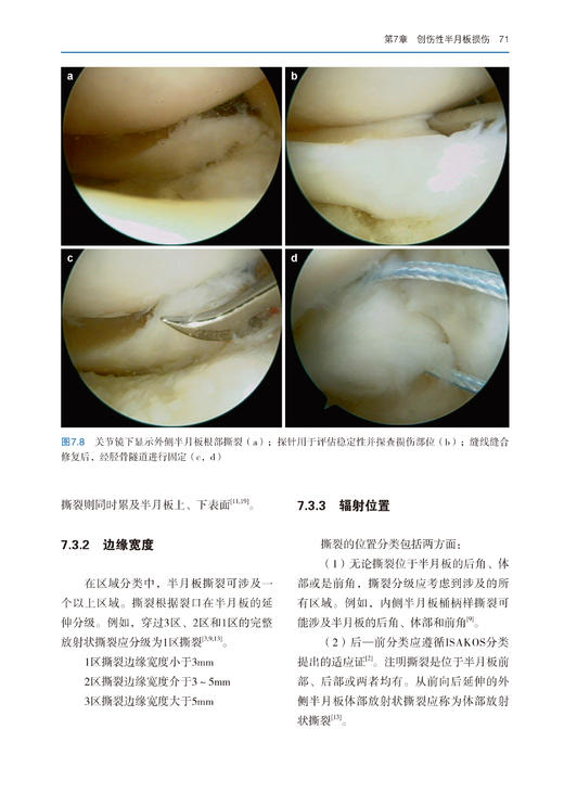 75折包邮《半月板手术学》 商品图1