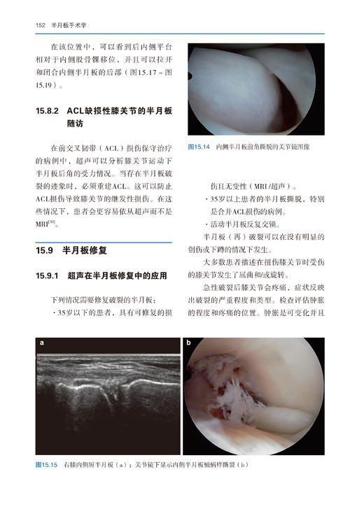 75折包邮《半月板手术学》 商品图4