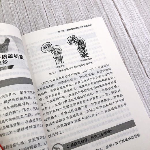 关爱骨骼，守护健康——骨质疏松症防治160问 商品图8