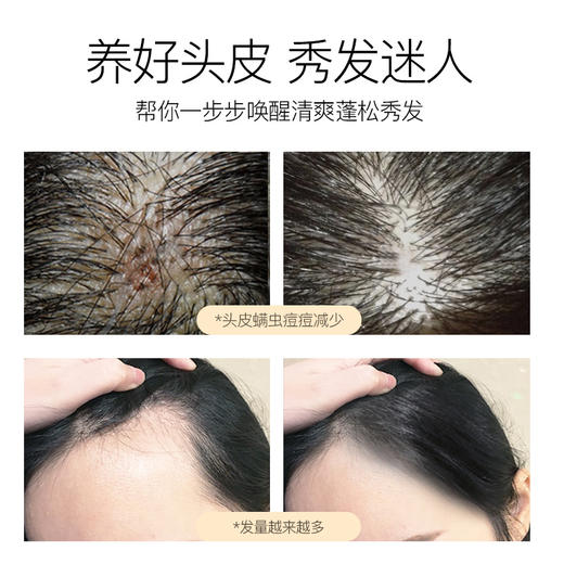 Anfany生姜海盐控油洗头膏，生姜改善落发，海盐深层清洁 商品图3