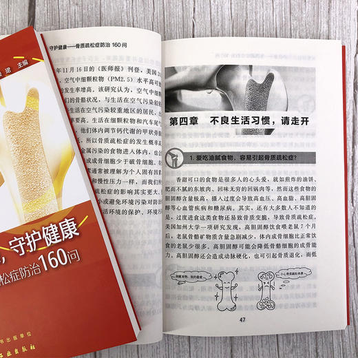 关爱骨骼，守护健康——骨质疏松症防治160问 商品图6