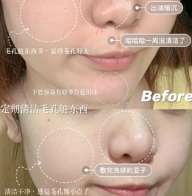  【油皮必备-纽西之谜火山泥膜】强力吸附、控油、深层清洁、紧致毛孔，男士可用