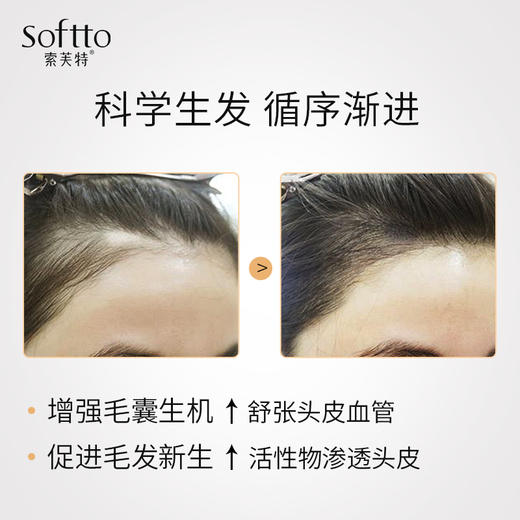 索芙特防脱育发滋养液，4D靶向技术，32年防脱育发专研科技，科学生发 商品图3
