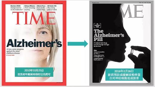 【阿尔兹海默症专题课】 会员半价听，购买后可邀请2名好友免费听课 商品图0