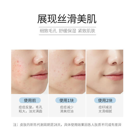 维美维侬银离子驱螨净肤皂，银离子抑菌，三重除螨配方，除螨“小银蛋” 商品图3