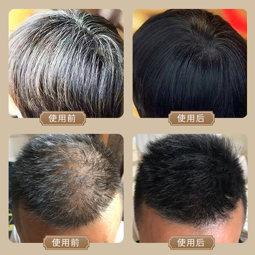 修正黑灵芝首乌洗发水中老年乌发男女老少都适用育发特证白发转黑防