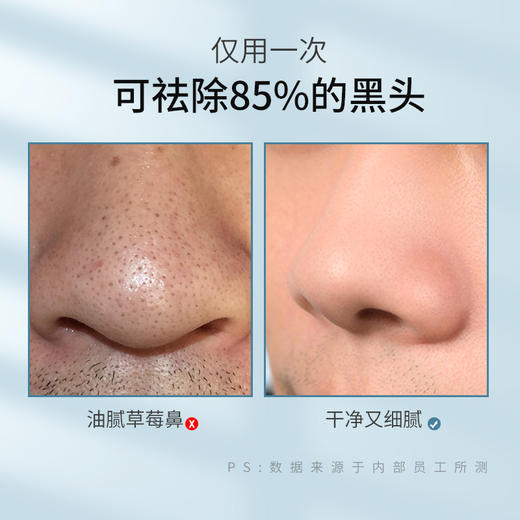 泉仕乳糖酸去黑头鼻贴，一导二刮三收，温和细致，正确扫“黑” 商品图2
