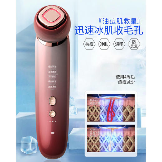 MESMOOOTH全能美容护肤仪，琥珀光深层清洁，蓝光抗痘，迅速冰肌收毛孔，四色彩光嫩肤，御龄黑科技 商品图1