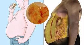  天然“消食片”，好吃又享“瘦”，你可能真的只是虚胖 