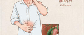  秋冬易发作的胆结石，也能艾灸调理！这些配穴你知道吗？ 
