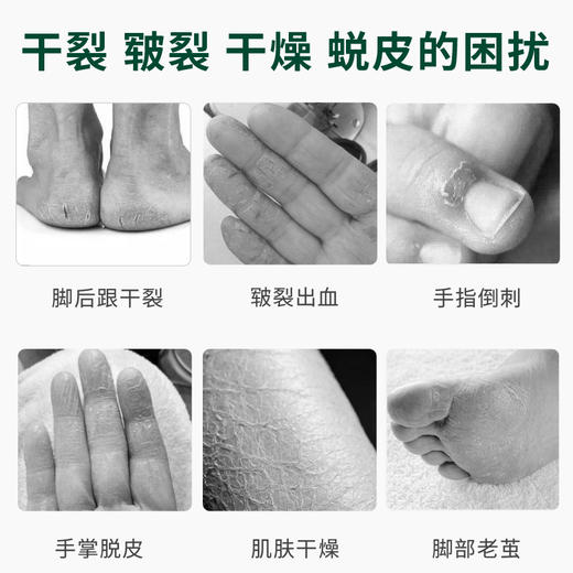 杨四郎橄榄油皲裂膏，富含角鲨烯，亲肤易吸收，天然果油，深入修护 商品图3