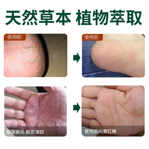 杨四郎橄榄油皲裂膏，富含角鲨烯，亲肤易吸收，天然果油，深入修护 商品图4