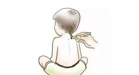  39博客 |用艾灸和搓痧帮助孩子退烧 