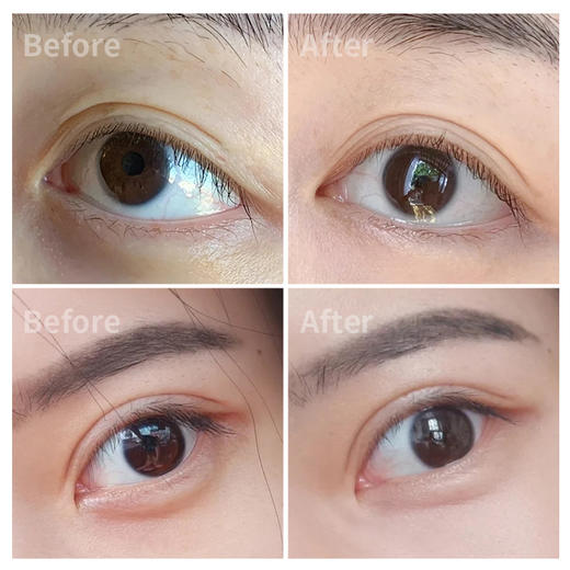 兰蔻发光眼霜小黑瓶肌底精华眼霜15ml  商品图3