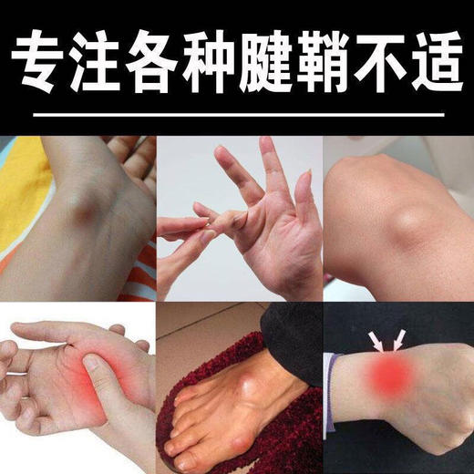 买二送一！！腱鞘炎药膏大拇指鼓包手指手腕关节疼痛手肘腱鞘囊肿胳膊疼痛膏 商品图8