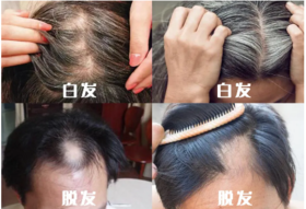  洗一次黑一次！头发越洗越多，而且一根也不掉！这国家认证的洗发水神了！ 