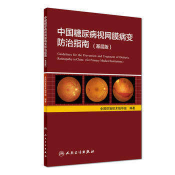 中国糖尿病视网膜病变防治指南（基层版） 商品图0