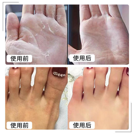 【第2件半价】BIOREVE法国雪鹿红参精粹法国原装进口北极鹿油+上等红参精粹修护干裂抚平毛刺深层滋养修护肌底 商品图1